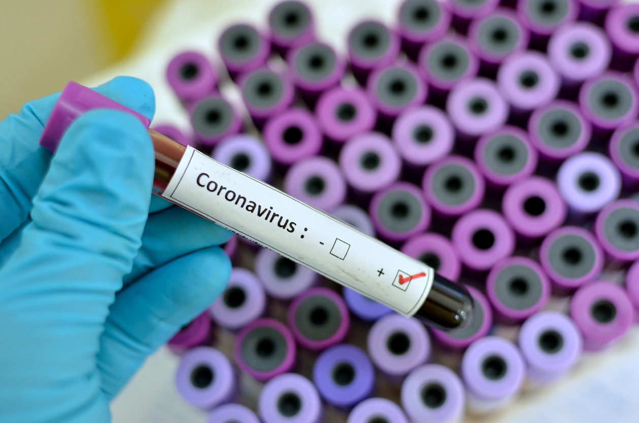 Featured image for "COVID-19: Cases in Aylmer continue to rise"